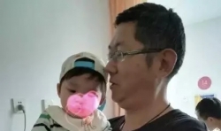 千家愛(ài)：為了一個(gè)先心病與唇腭裂的棄嬰